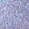 12 Pack: 5.7oz. Chunky Polyester Glitter by Recollections™